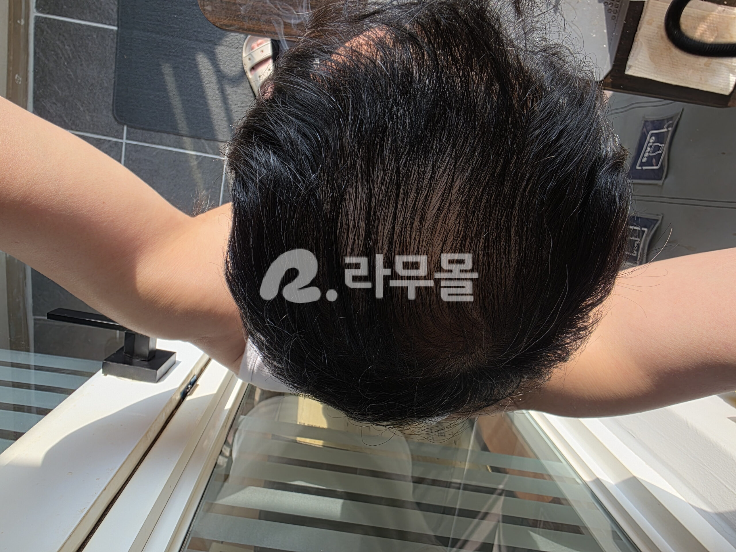 미녹시딜 민주브 5mg 직구 후기