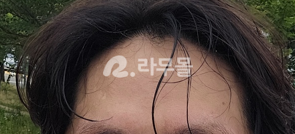 프로페시아 핀페시아 직구 후기